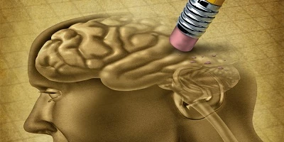 Existuje příčinná souvislost mezi zánětem dásní a Alzheimerovou chorobou?