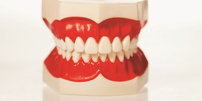 Parodontitida - riziko pro zuby a dásně i celkové zdraví