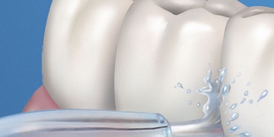 Efektivní čištění zubů pomocí pulzujícího paprsku vody