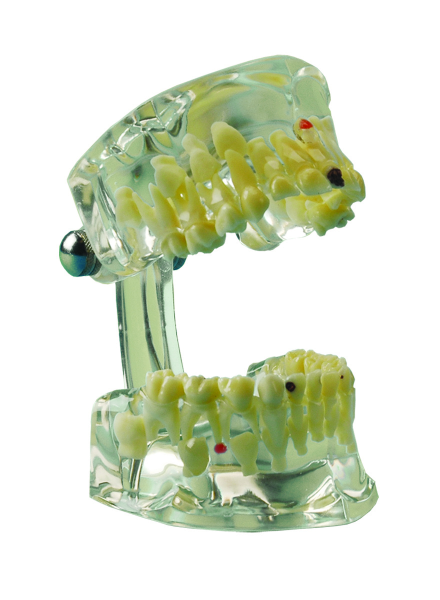 Miradent Fantom CHILD model zubů, transparentní