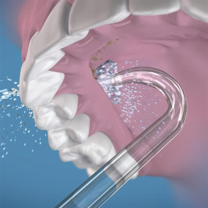 Waterpik Implant Denture Tip  náhradní trysky, 2 ks