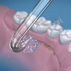 Waterpik Implant Denture Tip  náhradní trysky, 2 ks