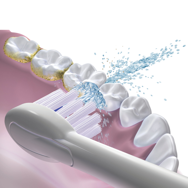 Waterpik Sonic Fusion Professional SF-02 White, sonický kartáček s ústní sprchou